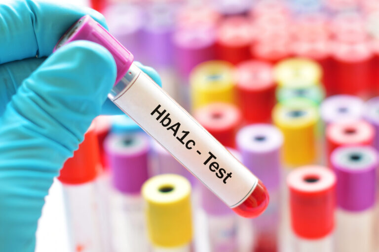 HbA1c diabetes test